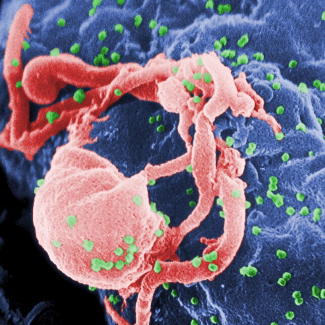La Infección por Helmintos Puede Reducir La Transmisión Del VIH y la Enfermedad.