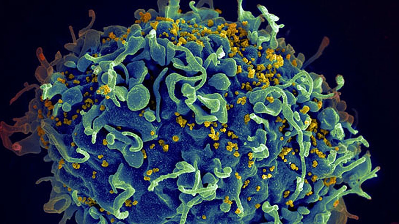 Identificada una diana celular para eliminar el reservorio del VIH