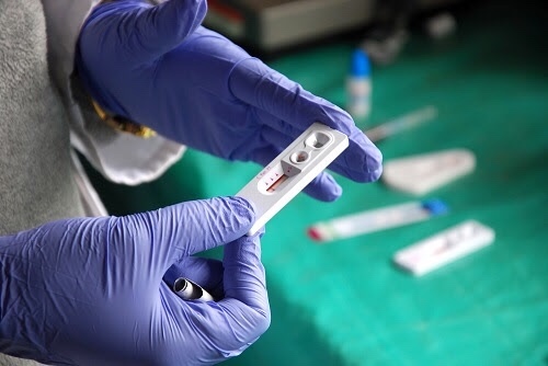 Las pruebas rápidas no siempre son precisas en las pruebas de VIH, VHC,VHB