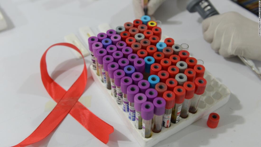 En el Día Mundial del SIDA, estos tres grandes desafíos se interponen en el camino de la investigación del VIH / SIDA