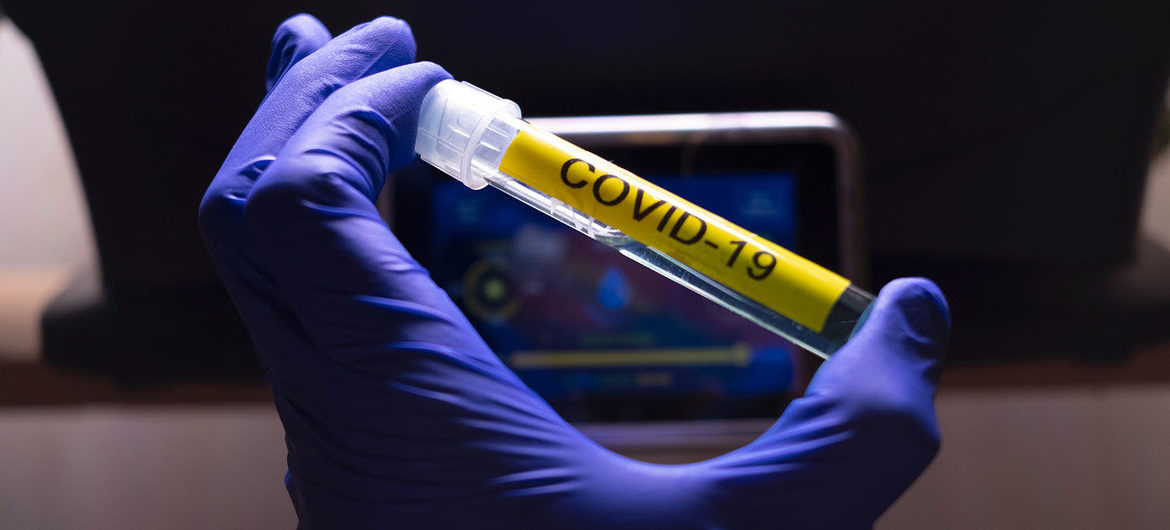 La pandemia del coronavirus se está acelerando: hay que pasar de la defensa al ataque