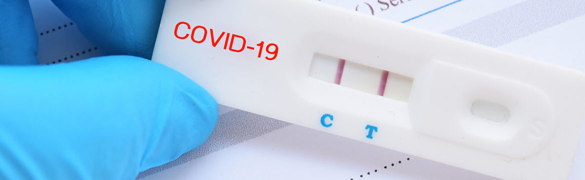 Declaración conjunta de ASA y APSF sobre pruebas perioperatorias para el virus COVID-19  29 de abril de 2020