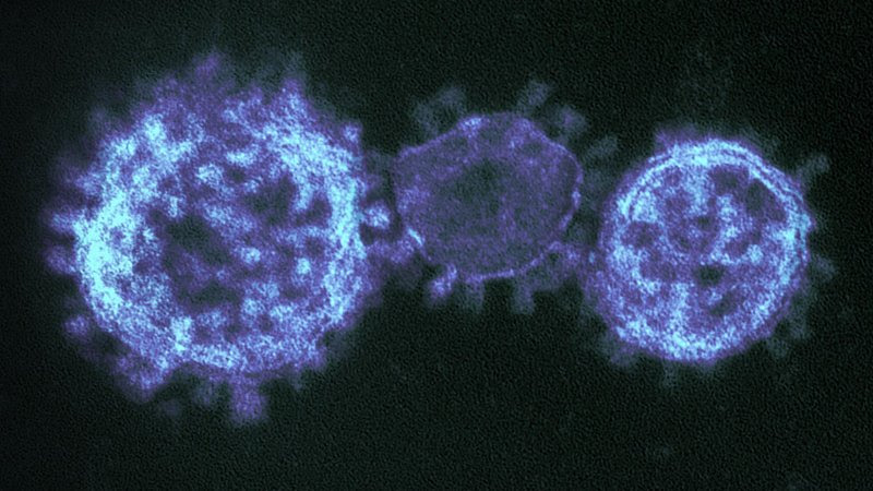 El curso de cinco días de antivirales orales parece detener el SARS-CoV-2 en su camino