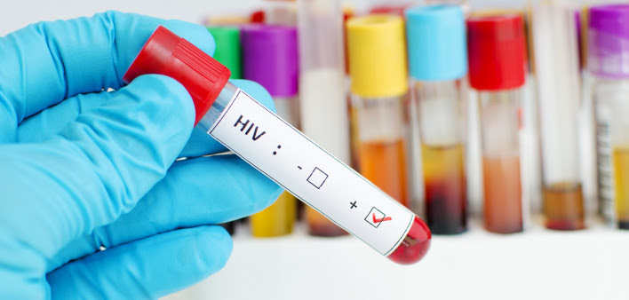 ¿Cómo puedo saber si tengo VIH?