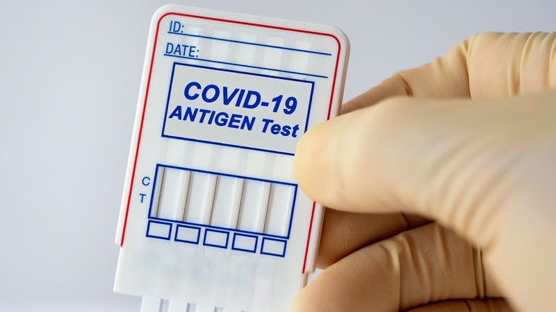 IDSA vuelve a examinar el papel de las pruebas de antígenos para el SARS-CoV-2 en este momento de la pandemia