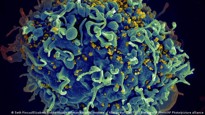 Científicos afirman que mujer argentina se habría curado de VIH por inmunidad natural 