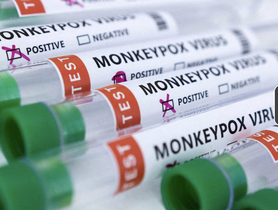 ADN de viruela del mono encontrado en semen de varios pacientes