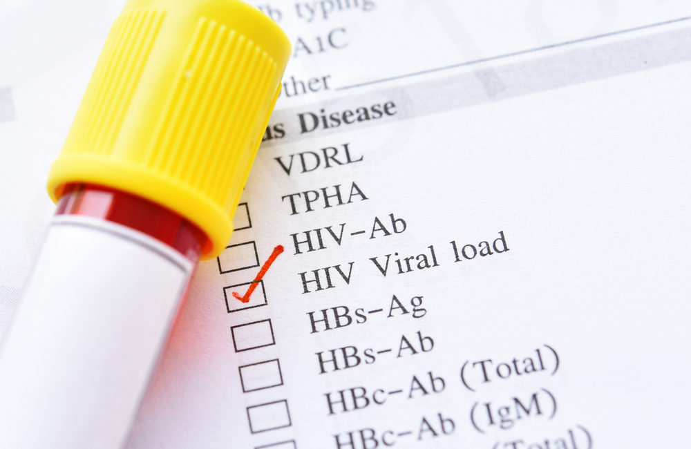 Los repuntes de bajo nivel de VIH y carga viral son importantes señales de advertencia, según un estudio europeo