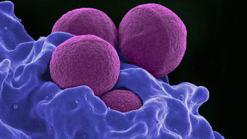 Un nuevo antibiótico podría combatir las superbacterias resistentes a múltiples fármacos